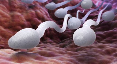 Verhütung (Vasektomie)