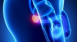 Gutartige Prostatavergrößerung -
