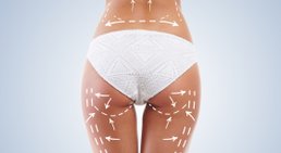 Fettabsaugung (Liposuktion) -