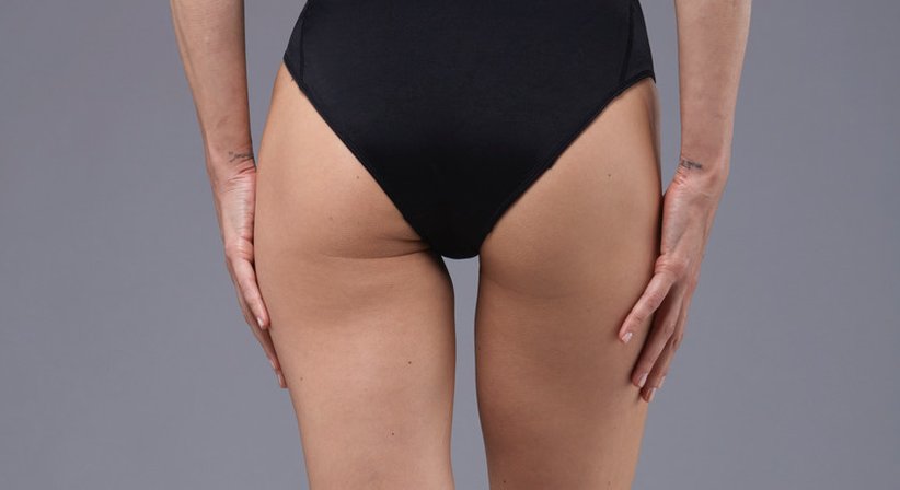 Fettabsaugung (Liposuktion) - Dr. Stefan Gärner - Plastischer Chirurg Wien 1180