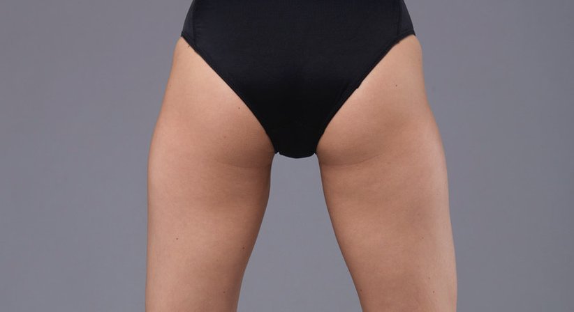 Intimchirurgie - Dr. Stefan Gärner - Plastischer Chirurg Wien 1180