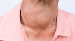 Hyperthyreose -