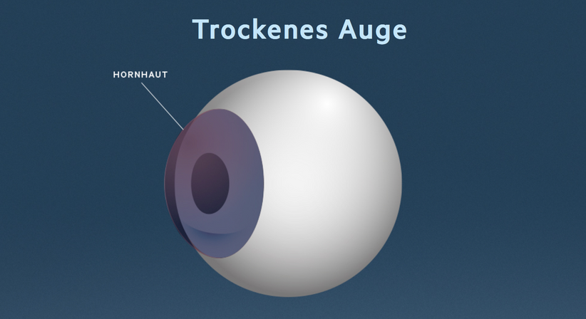 Trockenes Auge - Prof. Dr. Martin Dirisamer, FEBO - Augenarzt Linz 4020
