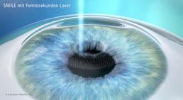 Prof. Dr. Martin Dirisamer, FEBO - Augenarzt Linz 4020