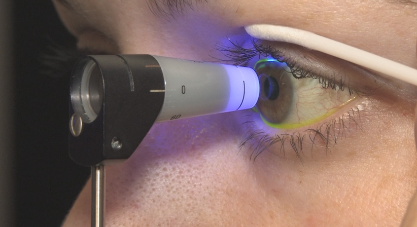 Grüner Star (Glaukom) - Prof. Dr. Martin Dirisamer, FEBO - Augenarzt Linz 4020