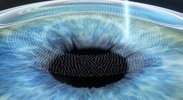 Priv.Doz. OA Dr. Martin Dirisamer, FEBO - Augenarzt Linz 4020