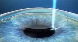 Priv.Doz. OA Dr. Martin Dirisamer, FEBO - Augenarzt Linz 4020
