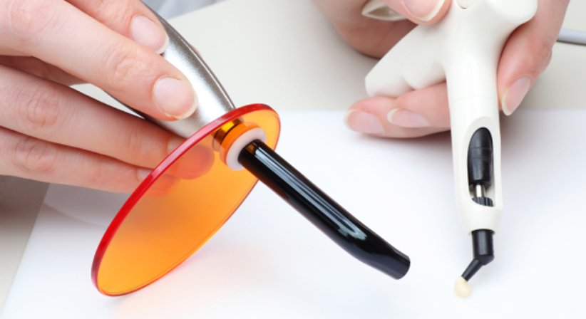 Composit Füllungen ("weiße Füllungen") - Dr. Bernhard Witzmann - Zahnarzt Wien 1190