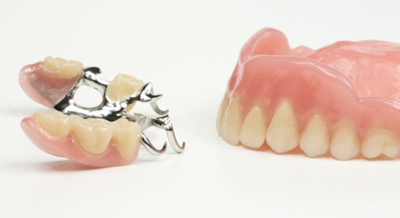 Teil und Totalprothesen - Dr. Bernhard Witzmann - Zahnarzt Wien 1190