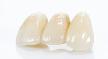 Vollkeramische Kronen & Brücken