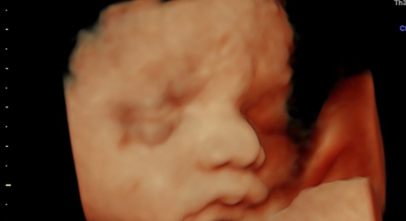 3D/4D Ultraschall - Dr. med. Gerald Bräutigam - Frauenarzt Linz 4020