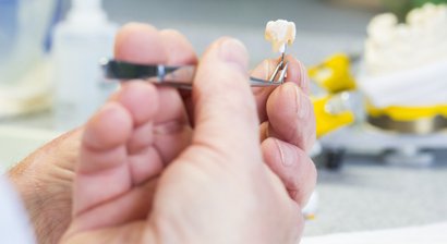 zahnfarbene Kunststofffüllungen, Gold,-Keramik Inlays