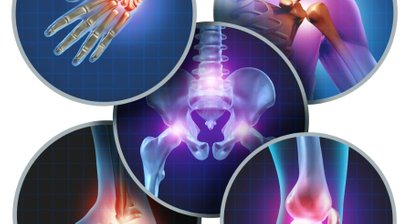 Entzündliche Gelenkerkrankungen