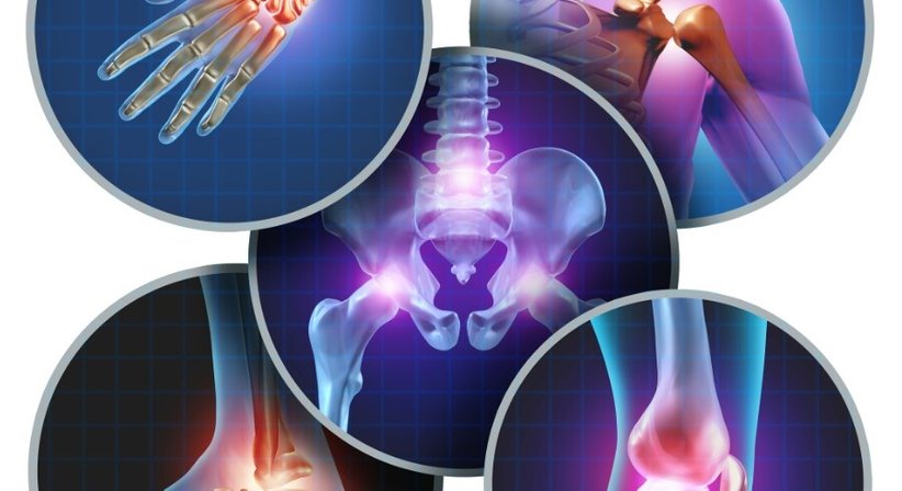 Entzündliche Gelenkerkrankungen - Priv.-Doz. Dr. Christian Muschitz - Internist Wien 1010