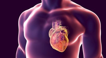 Herz-Kreislauf-Erkrankungen