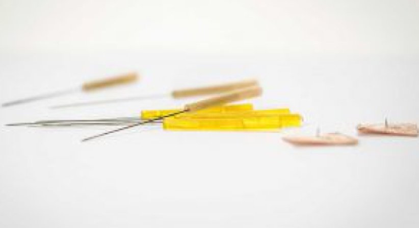 Akupunktur - Dr. Susanne Steindl - Praktische Ärztin Wien 1010