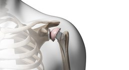 OA Dr. Markus Winnisch, MSc - Orthopäde Wien 1090