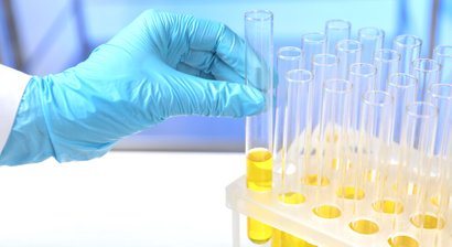 Labordiagnostik / Blutabnahme / Harn- und Stuhlanalyse