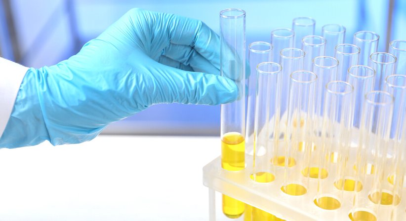 Labordiagnostik / Blutabnahme / Harn- und Stuhlanalyse - Dr. Daryoush Afshar-Ebrahimi - Praktischer Arzt Wien 1170