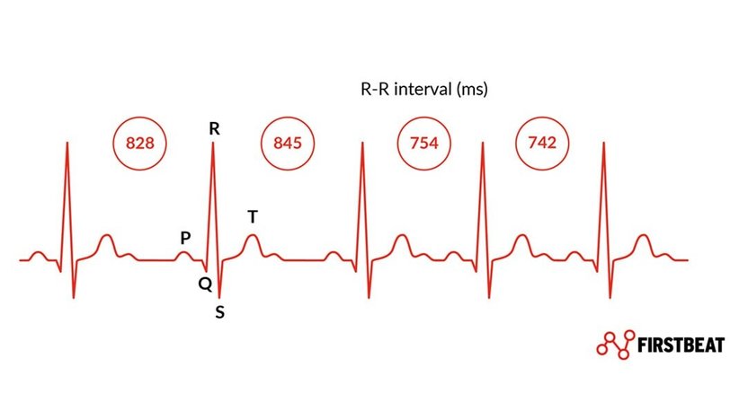 HRV-Messung (Herzratenvariabilität) - Dr. Thomas Laimer - Praktischer Arzt Leobersdorf 2544