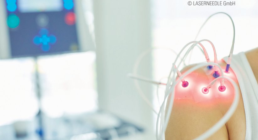 Laserneedle-Therapie - Dr. Thomas Laimer - Praktischer Arzt Leobersdorf 2544