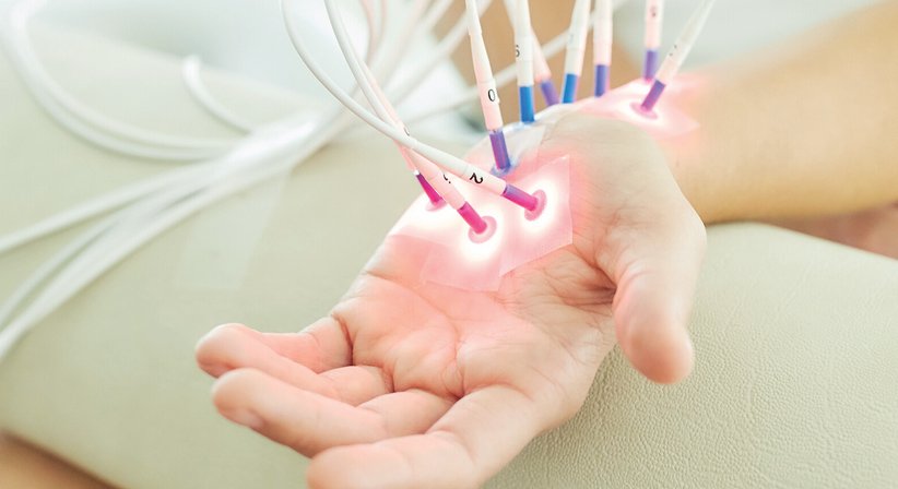 Laserneedle-Therapie - Dr. Thomas Laimer - Praktischer Arzt Leobersdorf 2544
