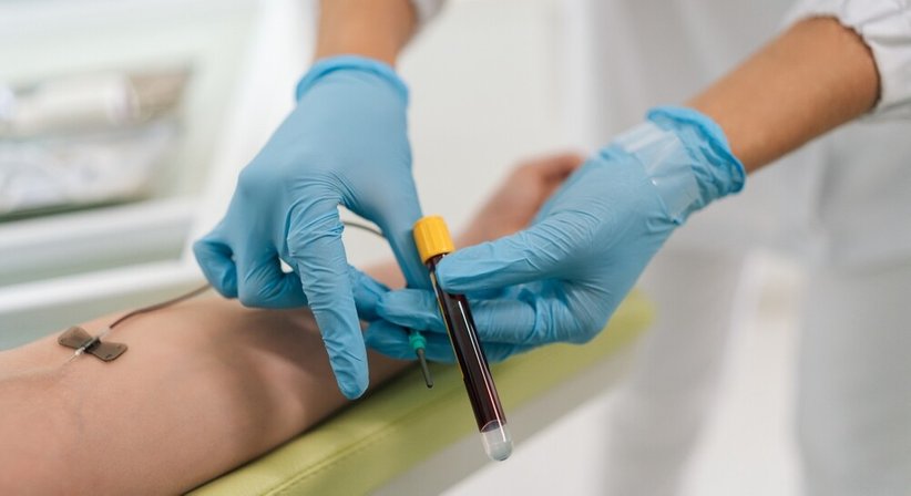 Eigenbluttherapie - Dr. med. univ. Iris Kamellor - Orthopädin Wien 1180