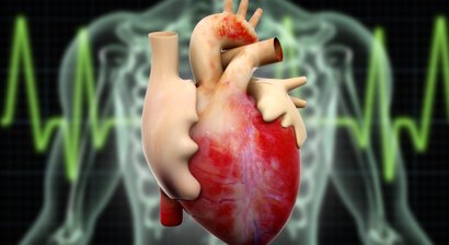 Koronare Herzkrankheit