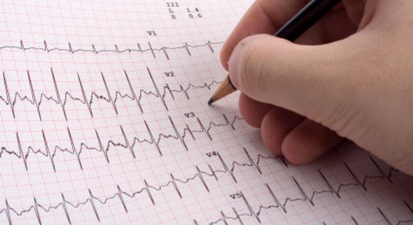 Langzeit EKG - Dr. Ivica Jukic - Internist Wien 1130