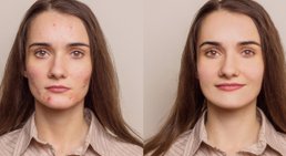 Priv.- Doz. Dr. Martin Inzinger - Hautarzt St.Veit/Glan 9300
