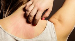 Priv.- Doz. Dr. Martin Inzinger - Hautarzt St.Veit/Glan 9300