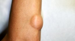 Priv.- Doz. Dr. Martin Inzinger - Hautarzt St.Veit/Glan 9300