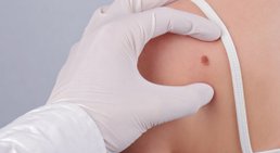 Priv.- Doz. Dr. Martin Inzinger - Hautarzt St.Veit/Glan 9300