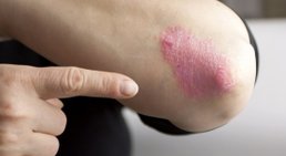 Priv.- Doz. Dr. Martin Inzinger - Hautarzt St.Veit/Glan 9300