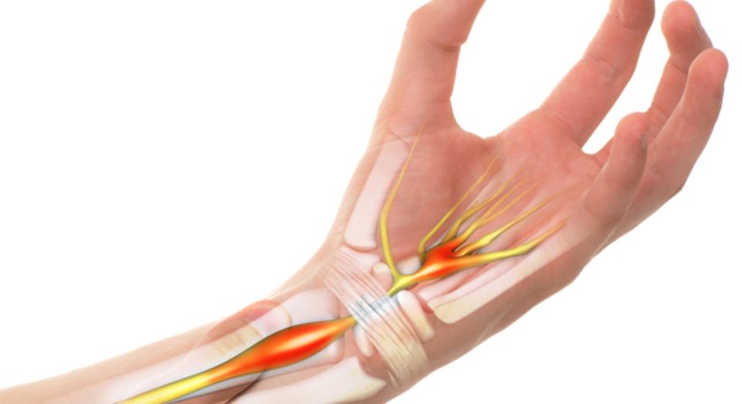 Nervenchirurgie - Prim. Priv.-Doz. Dr. Manfred Schmidt, FEBOPRAS - Plastischer Chirurg Linz 4020