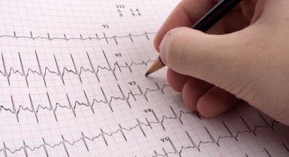 Langzeit EKG