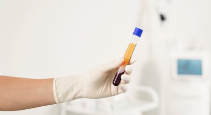 PRP- und Eigenbluttherapie