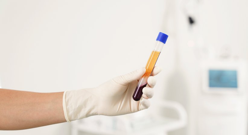 PRP- und Eigenbluttherapie bei Priv.-Doz. Dr. Philipp Heuberer