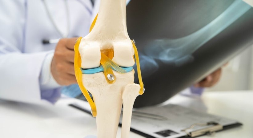 Kniebehandlung bei Priv.-Doz. Dr. Philipp Heuberer
